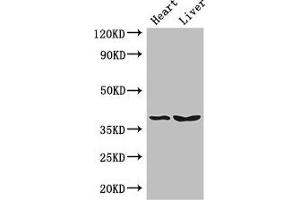 Western Blot Positive WB detected in: Mouse heart tissue, Mouse liver tissue All lanes: CTSB antibody at 3 μg/mL Secondary Goat polyclonal to rabbit IgG at 1/50000 dilution Predicted band size: 38 kDa Observed band size: 38 kDa (Cathepsin B Antikörper  (AA 82-333))
