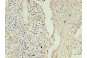 Immunohistochemistry (IHC) image for anti-Keratin 8 (KRT8) (AA 2-483) antibody (ABIN7157464)