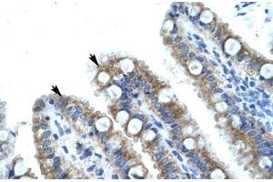 Immunohistochemical staining (Formalin-fixed paraffin-embedded sections) of human intestine with MECOM polyclonal antibody .