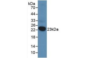 Detection of Recombinant DUSP3, Human using Monoclonal Antibody to Dual Specificity Phosphatase 3 (DUSP3) (Dual Specificity Phosphatase 3 (DUSP3) (AA 2-185) Antikörper)