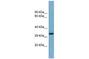 WB Suggested Anti-OTUD6B Antibody Titration: 0. (OTUD6B Antikörper  (Middle Region))