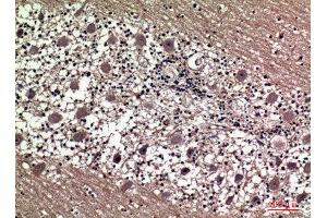 Immunohistochemistry (IHC) image for anti-Prolactin (PRL) (Internal Region) antibody (ABIN6281197)