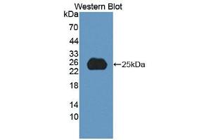 Western blot analysis of recombinant Human SPP2. (SPP2 Antikörper  (AA 30-211))