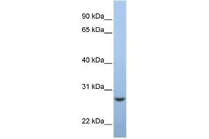 WB Suggested Anti-C15orf24 Antibody Titration:  0. (Emc7 Antikörper  (Middle Region))