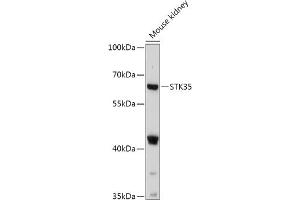 Western blot analysis of extracts of Mouse kidney, using STK35 antibody (ABIN7270225) at 1:1000 dilution. (STK35 Antikörper  (AA 190-380))