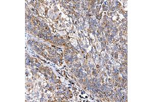 IHC analysis of RAB7/RAB7A using anti-RAB7/RAB7A antibody (ABIN7600597).