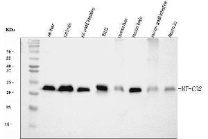 Western blot analysis of MT-CO2 using anti-MT-CO2 antibody (ABIN7599081). (COX2 Antikörper  (AA 1-205))