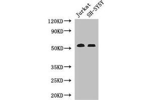 Western Blot Positive WB detected in: Jurkat whole cell lysate, SH-SY5Y whole cell lysate All lanes: TGFBR1 antibody at 4 μg/mL Secondary Goat polyclonal to rabbit IgG at 1/50000 dilution Predicted band size: 56, 57, 48 kDa Observed band size: 56 kDa (TGFBR1 Antikörper  (AA 157-244))