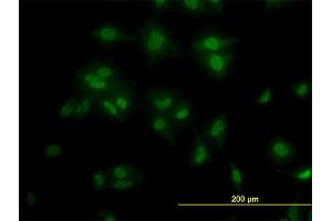 Immunofluorescence of monoclonal antibody to TCF7L2 on HeLa cell.