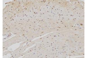 ABIN6273372 at 1/100 staining Rat heart tissue by IHC-P. (NOC4L Antikörper  (Internal Region))