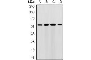 Western blot analysis of RMDN3 expression in HepG2 (A), MCF7 (B), mouse liver (C), mouse brain (D) whole cell lysates. (RMDN3 Antikörper)