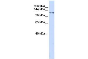 WB Suggested Anti-XPO5 Antibody Titration:  0. (XPO5 Antikörper  (N-Term))