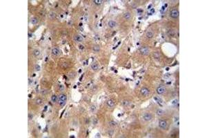 TRPM8 antibody immunohistochemistry analysis in formalin fixed and paraffin embedded human liver tissue. (TRPM8 Antikörper  (AA 263-292))
