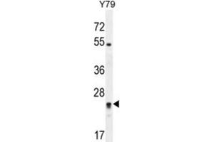 Western Blotting (WB) image for anti-Deleted in Primary Ciliary Dyskinesia Homolog (DPCD) antibody (ABIN2995873) (DPCD Antikörper)