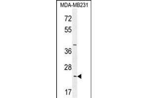 SYCE2 Antibody (N-term) (ABIN654371 and ABIN2844127) western blot analysis in MDA-M cell line lysates (35 μg/lane).
