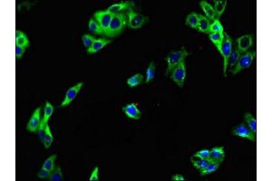 Immunofluorescent analysis of HepG2 cells using ABIN7158114 at dilution of 1:100 and Alexa Fluor 488-congugated AffiniPure Goat Anti-Rabbit IgG(H+L) (LRRTM4 Antikörper  (AA 259-419))