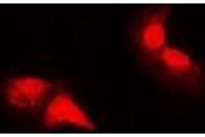 Immunofluorescent analysis of HER2 staining in MCF cells. (ErbB2/Her2 Antikörper  (C-Term))