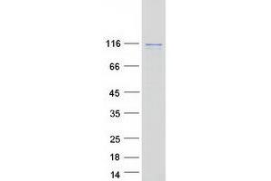 Western Blotting (WB) image for Histone Deacetylase 7 (HDAC7) (Transcript Variant 2) protein (Myc-DYKDDDDK Tag) (ABIN2722793)