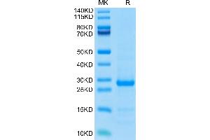 TK1 Protein (AA 2-242) (His tag)