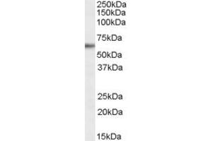 Western Blotting (WB) image for anti-Glycine/Arginine Rich Protein 1 (GRRP1) (N-Term) antibody (ABIN2791567) (GRRP1 Antikörper  (N-Term))