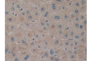 Detection of PACAP in Human Liver Tissue using Polyclonal Antibody to Pituitary Adenylate Cyclase Activating Peptide (PACAP) (Pituitary Adenylate Cyclase Activating Peptide (AA 17-176) Antikörper)