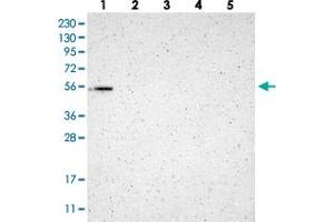 Western blot analysis of Lane 1: RT-4, Lane 2: Human Plasma, Lane 3: U-251 MG, Lane 4: Liver, Lane 5: Tonsil with GMEB2 polyclonal antibody  at 1:250-1:500 dilution.