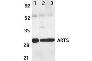 Western blot analysis of ARTS expression in human lung (lane 1), spleen (lane 2), and kidney (lane 3) tissue lysates with AP30082PU-N ARTS antibody at 2 μg /ml. (ARTS Antikörper)