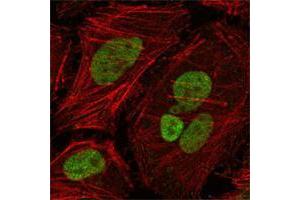 Confocal immunofluorescence analysis of Hela cells using MLH1 mouse mAb (green), showing nuclear localization. (MLH1 Antikörper  (AA 381-483))
