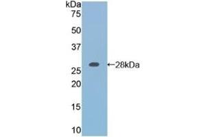 Detection of Recombinant RARa, Mouse using Polyclonal Antibody to Retinoic Acid Receptor Alpha (RARa)