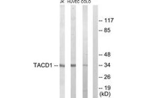 Western blot analysis of extracts from Jurkat/HuvEc/COLO205 cells, using TACD1 Antibody. (TACD1 (AA 116-165) Antikörper)