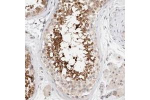 Immunohistochemical staining of human testis with C17orf97 polyclonal antibody  shows strong cytoplasmic positivity in subsets of seminiferus duct cells. (LIAT1/C17orf97 Antikörper)