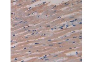 Used in DAB staining on fromalin fixed paraffin- embedded heart tissue (DMPK Antikörper  (AA 1-152))