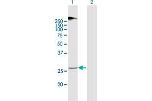 Western Blot analysis of TMEM38A expression in transfected 293T cell line by TMEM38A MaxPab polyclonal antibody. (TMEM38A Antikörper  (AA 1-299))