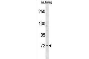 Western Blotting (WB) image for anti-Formin Binding Protein 1-Like (FNBP1L) antibody (ABIN2998844) (FNBP1L Antikörper)