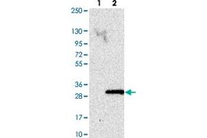 Western blot analysis of Lane 1: Negative control (vector only transfected HEK293T lysate). (ANAPC15 Antikörper)