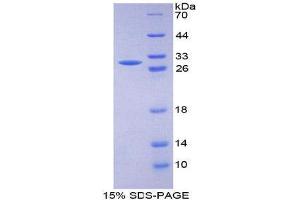 SDS-PAGE (SDS) image for Serum Response Factor (SRF) (AA 231-474) protein (His tag) (ABIN2126730) (SRF Protein (AA 231-474) (His tag))