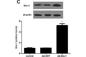 Western Blotting (WB) image for anti-Sulfiredoxin 1 (SRX1) (AA 45-137) antibody (ABIN1387599)