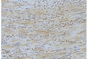 ABIN6275293 at 1/100 staining Mouse muscle tissue by IHC-P.