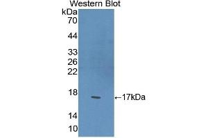 Detection of Recombinant PPARg, Mouse using Polyclonal Antibody to Peroxisome Proliferator Activated Receptor Gamma (PPARg) (PPARG Antikörper  (AA 149-273))