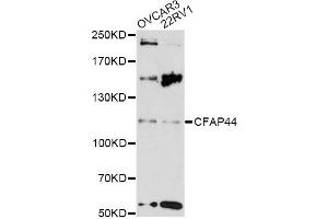 Western blot analysis of extracts of various cell lines, using CFAP44 antibody (ABIN6290455) at 1:3000 dilution. (WDR52 Antikörper)