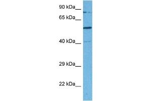 Host:  Rabbit  Target Name:  SMARCD2  Sample Tissue:  Human MDA-MB-435s Whole Cell  Antibody Dilution:  1ug/ml (SMARCD2 Antikörper  (C-Term))