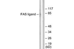 Western blot analysis of extracts from 293 cells, using FAS ligand Antibody. (FASL Antikörper  (AA 101-150))
