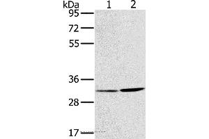 Western blot analysis of A172 and A375 cell, using HSD17B12 Polyclonal Antibody at dilution of 1:650 (HSD17B12 Antikörper)
