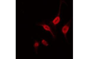 ABIN6266920 staining 293 by IF/ICC. (NEUROD2 Antikörper  (Internal Region))