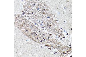 Immunohistochemistry of paraffin-embedded human brain using NMDA Rabbit mAb (ABIN7267420) at dilution of 1:100 (40x lens). (NMDAR2A Antikörper)