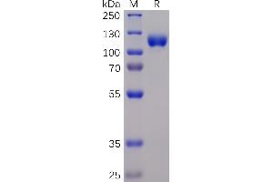SDS-PAGE (SDS) image for EPH Receptor A3 (EPHA3) (AA 21-541) protein (mFc-His Tag) (ABIN6961115)