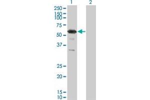 Western Blot analysis of RXRG expression in transfected 293T cell line by RXRG monoclonal antibody (M01), clone 6H1.