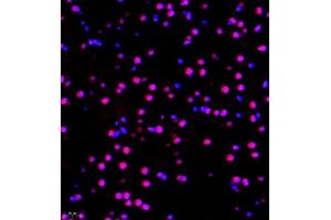 Immunofluorescence of paraffin embedded mouse brain using RBAK (ABIN7075383) at dilution of 1:400 (400x lens) (RBAK Antikörper)