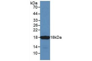 Detection of Recombinant SST, Mouse using Monoclonal Antibody to Somatostatin (SST) (Somatostatin Antikörper  (AA 27-116))