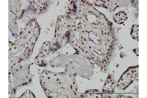 Immunoperoxidase of monoclonal antibody to ARID1B on formalin-fixed paraffin-embedded human placenta. (ARID1B Antikörper  (AA 1364-1460))